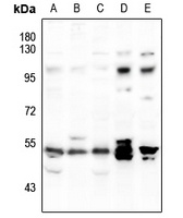 SYT Rabbit Polyclonal Antibody