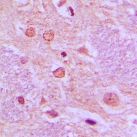 Anti-SYT Antibody