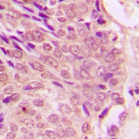 Anti-STAT1 (Phospho-S727) Antibody