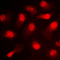Anti-STAT1 (Phospho-S727) Antibody