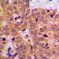 STAT1 Antibody