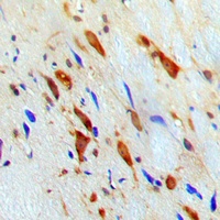STAT1 Antibody