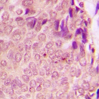 Anti-STAT3 (Phospho-S727) Antibody