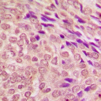 Anti-STAT3 Antibody