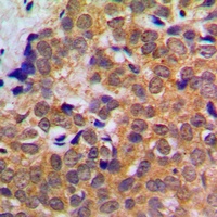 STAT5 Antibody