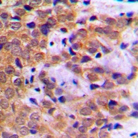 Anti-STAT5A (Phospho-S780) Antibody