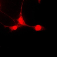Anti-STAT5A (Phospho-S780) Antibody