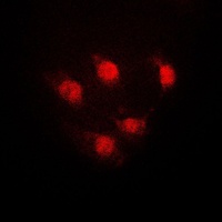 STAT5A Rabbit Polyclonal Antibody