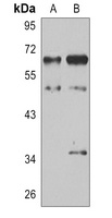 MST2 Rabbit Polyclonal Antibody