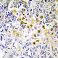 Anti-LKB1 (Phospho-S428) Antibody