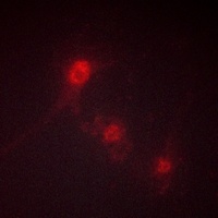 Anti-LKB1 (Phospho-S428) Antibody