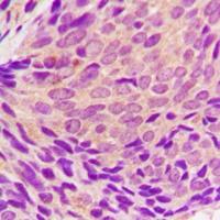 Anti-SYK (Phospho-Y323) Antibody