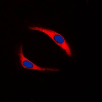 Anti-SYK (Phospho-Y323) Antibody