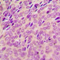 SYK (Phospho-Y348) Antibody