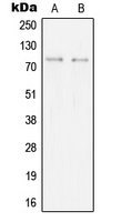 SYK Rabbit Polyclonal Antibody