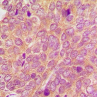 SYK Rabbit Polyclonal Antibody