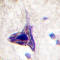 Synapsin 1 (Phospho-S62) Antibody
