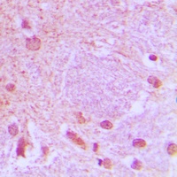 Anti-TCF3 Antibody