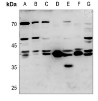 TCF7 Antibody