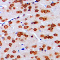 Anti-TCFL4 Antibody