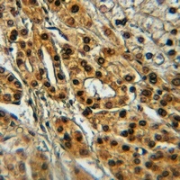 Anti-TIE2 (Phospho-Y1108) Antibody