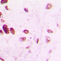 Anti-AP2 alpha/beta Antibody