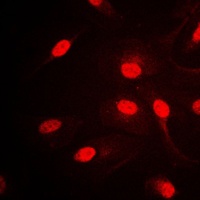 Anti-AP2 alpha/beta Antibody