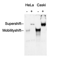 Anti-AP2 alpha/beta Antibody