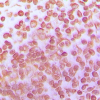Anti-TFDP1 Antibody