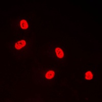 Anti-TFDP1 Antibody