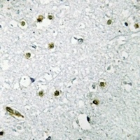 TFE3 Antibody