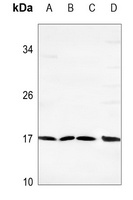 Spasmolysin Rabbit Polyclonal Antibody