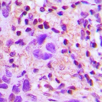 Anti-TGF beta 2 Antibody