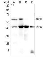 TGF beta 3 Rabbit Polyclonal Antibody