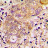 Anti-TGF beta 3 Antibody