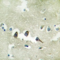 Anti-TGFBR2 Antibody