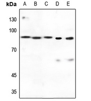Transglutaminase 2 Antibody