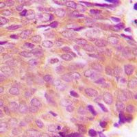 Anti-Transglutaminase 2 Antibody