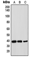 Thrombopoietin Antibody