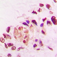 Anti-THRA Antibody