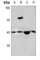 THRB Rabbit Polyclonal Antibody