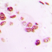 Anti-THRB Antibody