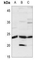 TIMP2 Rabbit Polyclonal Antibody