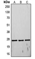 TIMP4 Antibody