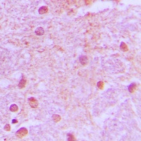 TLE4 antibody