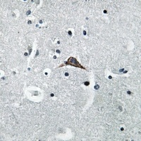 CD284 Rabbit Polyclonal Antibody