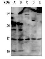 TNF alpha Antibody