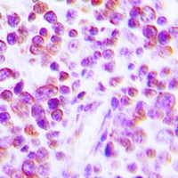 TNF alpha Antibody