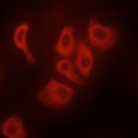 TNF alpha Antibody