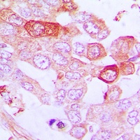 Anti-A20 Antibody